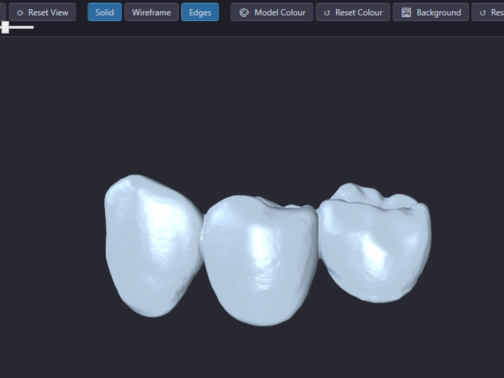 Dental lab STL viewer showing digital impression file attached to case in dental lab software